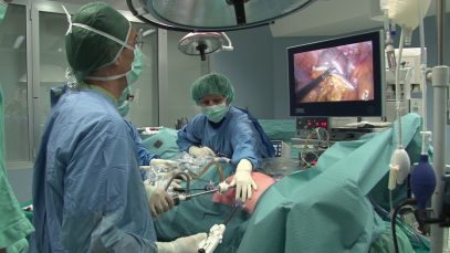 Emicolectomia destra videolaparoscopica per neoplasia del colon ascendente Roberto Petri, Massimo Vecchiato
